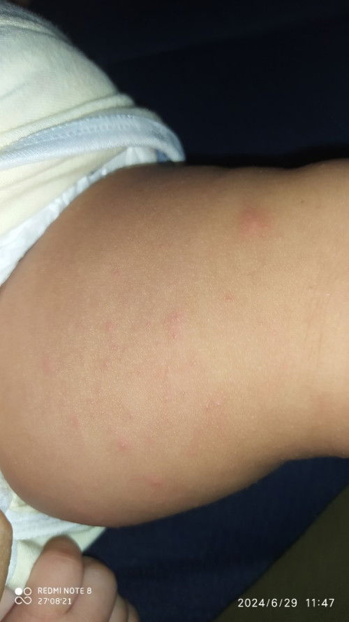 Bun ada yg pernah gk