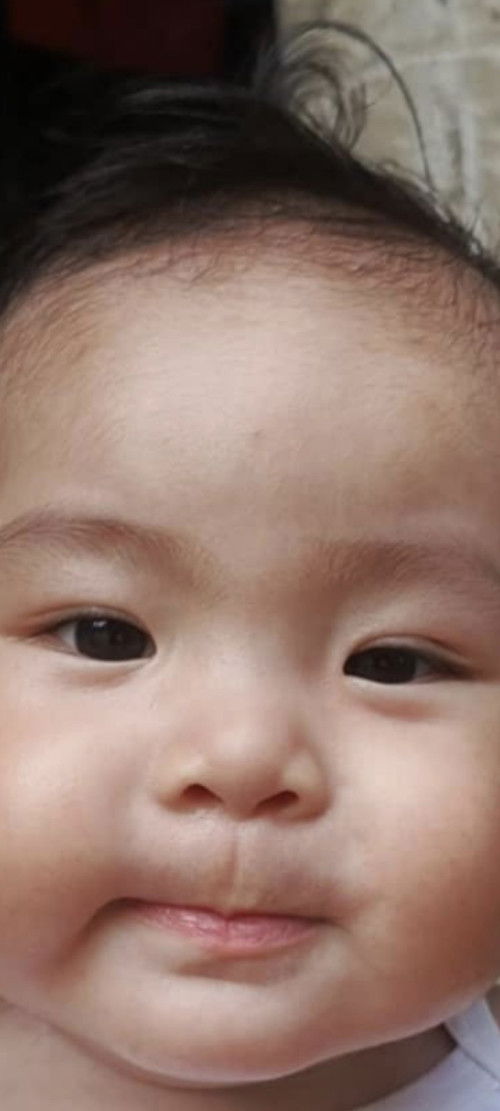 Normal lang po ba to na ganto? May nag sabi kasi na parang naduduling yung anak ko. 6mon old po