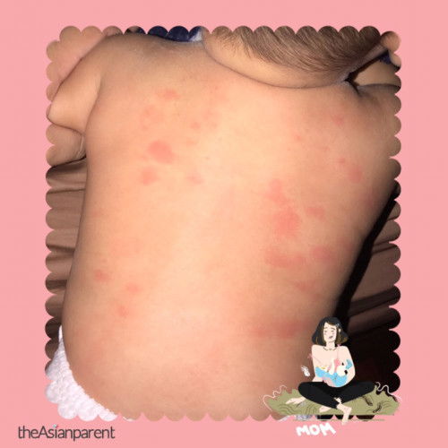 Ada tak ibu2 d sni ank kena macam ni? Peyakit apa ni ya. Shre please