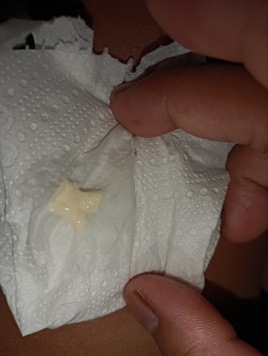 มีแผ่นขาวๆแบบนี้ในน้ำนมที่เราปั้มออกมาปกติไหมค่ะ