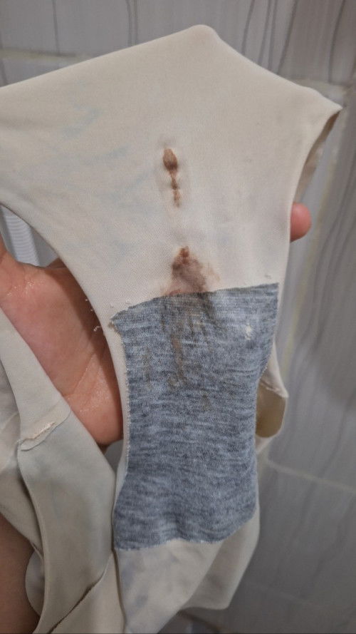 Flek cokelat 26 week