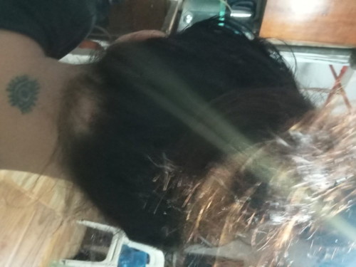 Hairloss problem