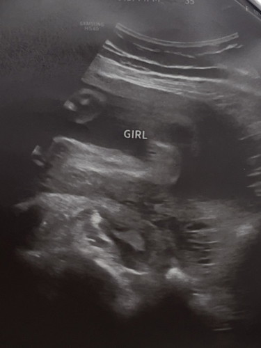 5 months preggy. girl na ba talaga??