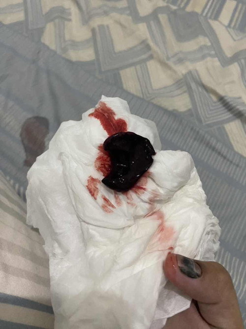 keluar gumpalan hati
