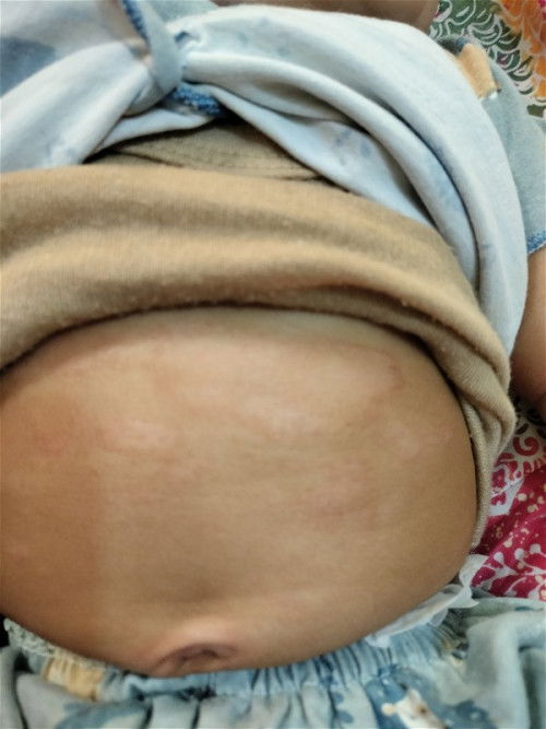 Bunn bayi ku umur 3bln kena jamur seperti ini obat nya apa ya