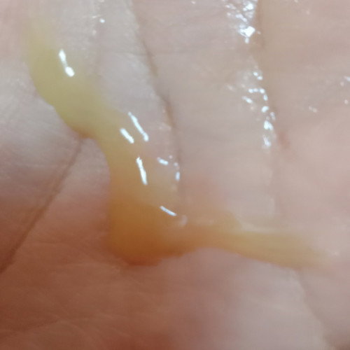 Kandungan 10weeks ade keluar lendir warna mcm ni normal ke