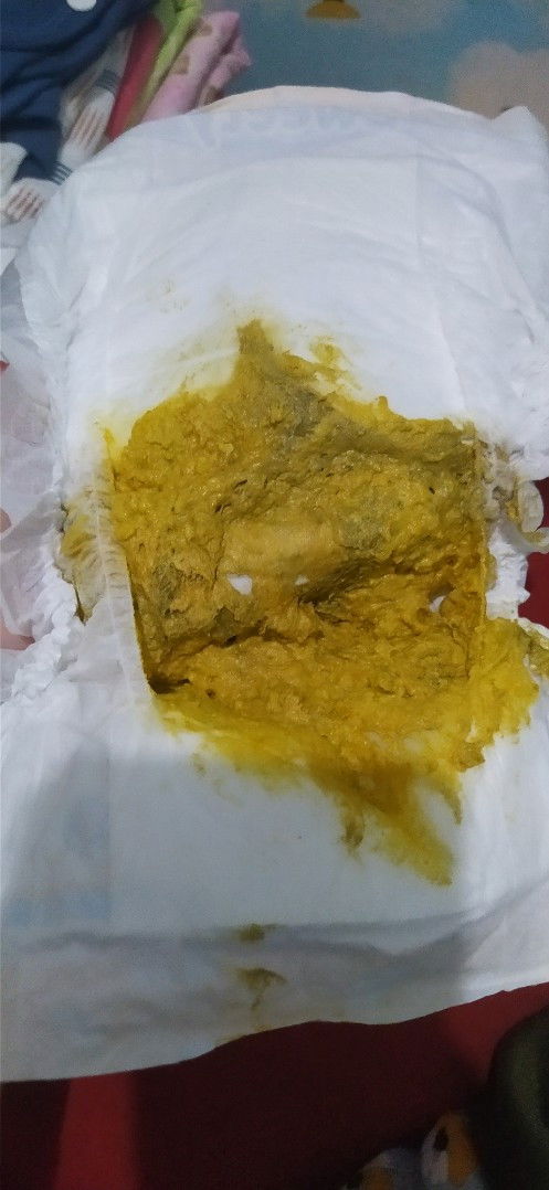 Pup bayi normal kah seperti ini? Kemarin2 tidak seperti ini bayiku sufor