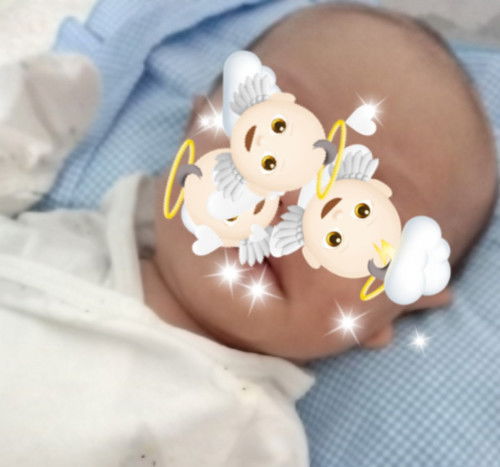 solusi rambut rontok newborn