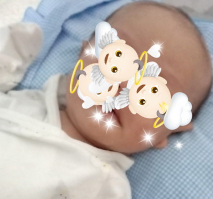 solusi rambut rontok newborn