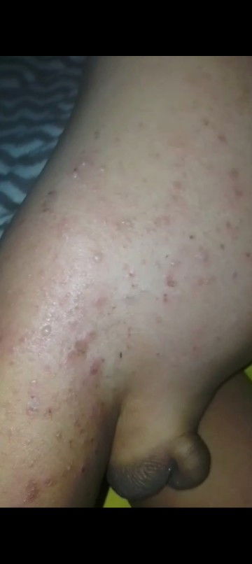 putih melenting seperti tersundut