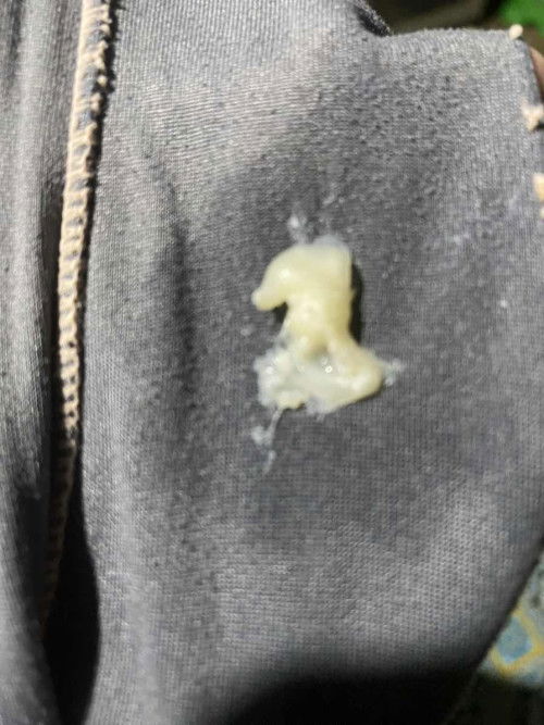 Usia kehamilan 40w 2d