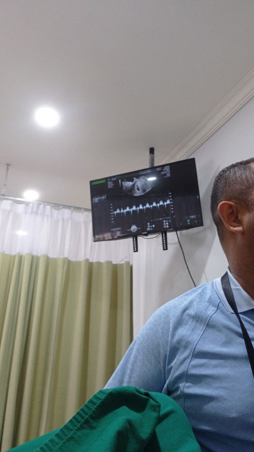 Pertama dengar detak jantung bayi