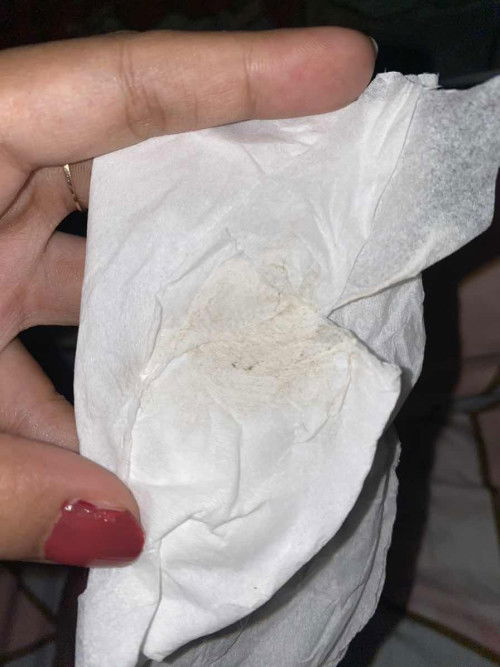 Usia kandungan 34w hpl agustus