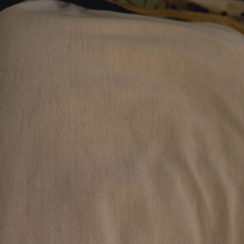 Normal po ba namamanot ang 6-weeks old baby ko?