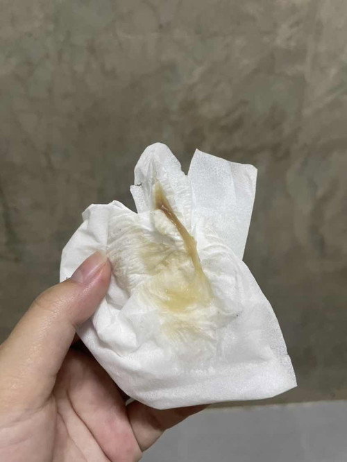 มีมูกสีน้ำตาลกี่วันถึงจะคลอดคะ