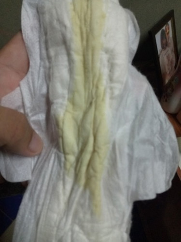 ตกขาวแบบนี้