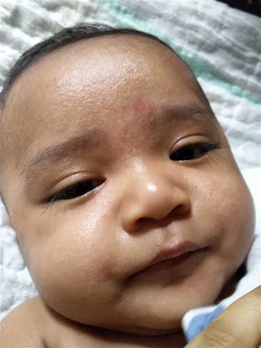 Why My Son Face Like That?