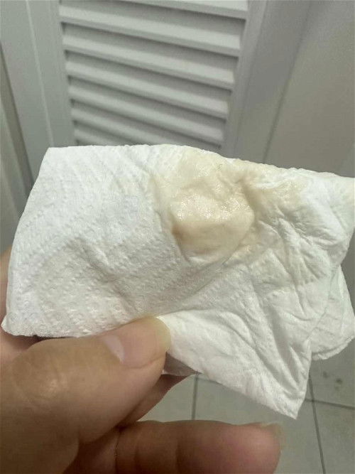 มีมูกลือดขณะตั้งครรภ์