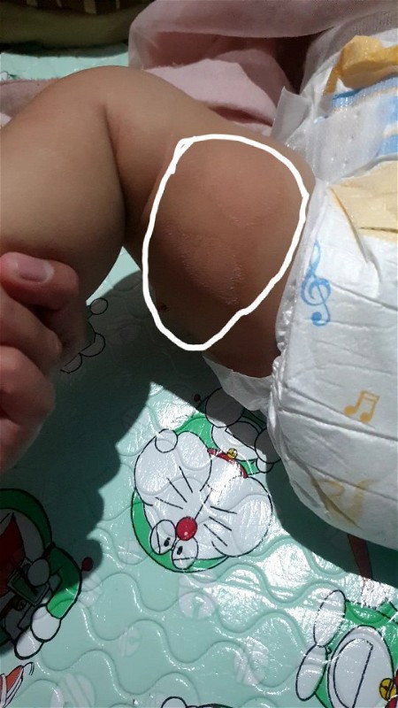 Kulit bayi