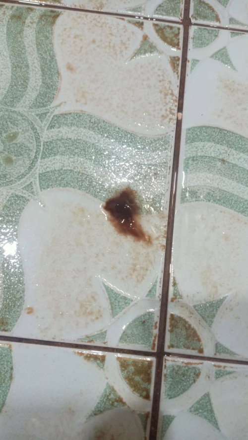 Keluar seperti ager" coklat kehitaman usia kehamilan 40 minggu 3 hari