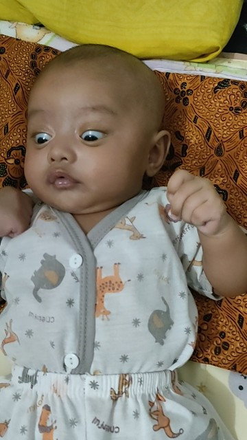 adakah yang bola mata baby nya kebawah seperti ini? sampe tinggal setengah gitu