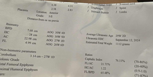 Measurements ng fetal biometry