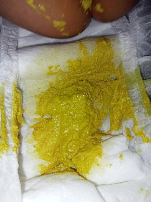 แบบนี้ถ่ายปกติ หรือถ่ายเสียคะ