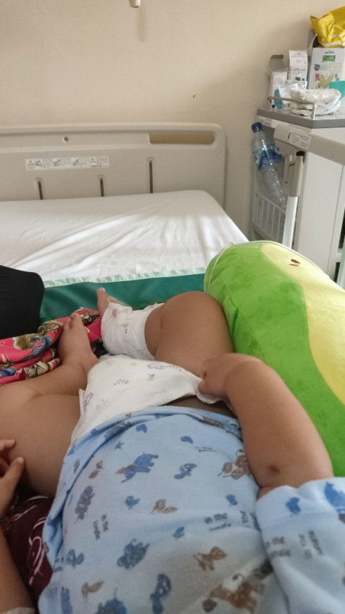 DIARE LEBIH DARI 10HARI