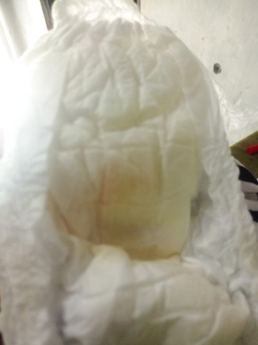 Bun, ini anak saya 5 bulan pipis dari jm 7-4 sore cuma segini, takut bgt kalo fomosis/ dehidrasi,