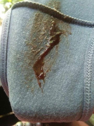 อยากสอบถามแม่ไปที่เคยโดนกระตุ้น