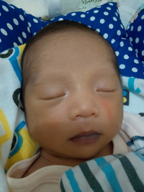 bibir bayi berwarna seperti ini normalkah?