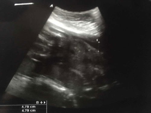 ดูไม่เป็นค่ะ ช่วยดูที