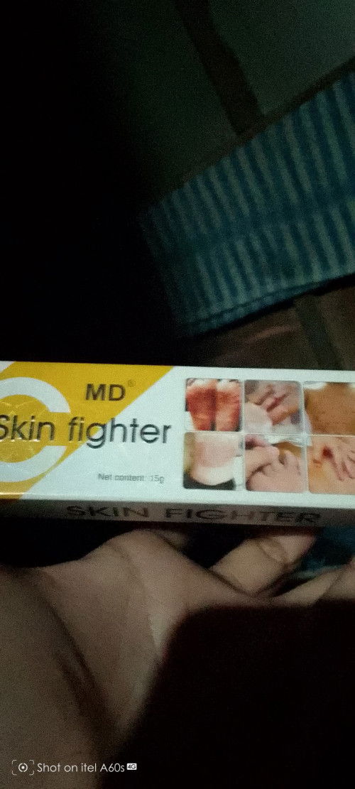 Magandang gamitin ang gamot na ito sa iyong anak na may diaper rash at sa gakat ng lamok