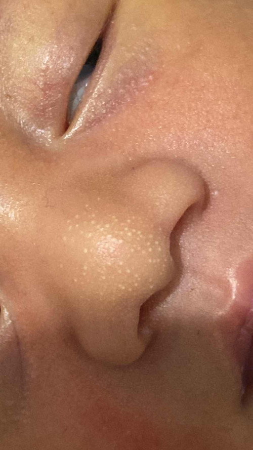 Skincare bayi
