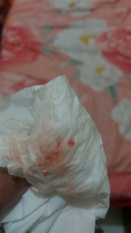 Maaf jorok bun gambarnya , apakah ini akan melahirkan ya.?