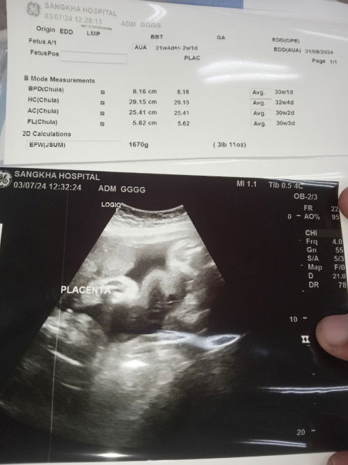 สวัสดีค่ะแม่ๆ