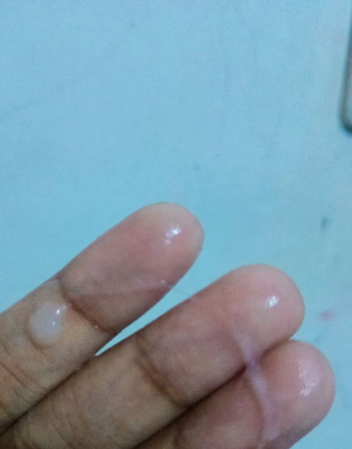 Keputihan kaya ingus