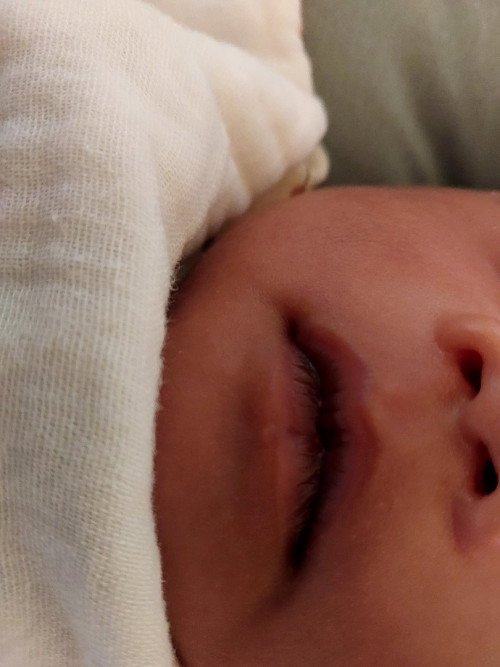 Bibir bayi berwarna gelap