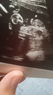 28week baru tunjuk jantina