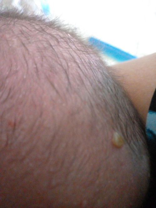 Ada yang tau bund, ini obatny apa