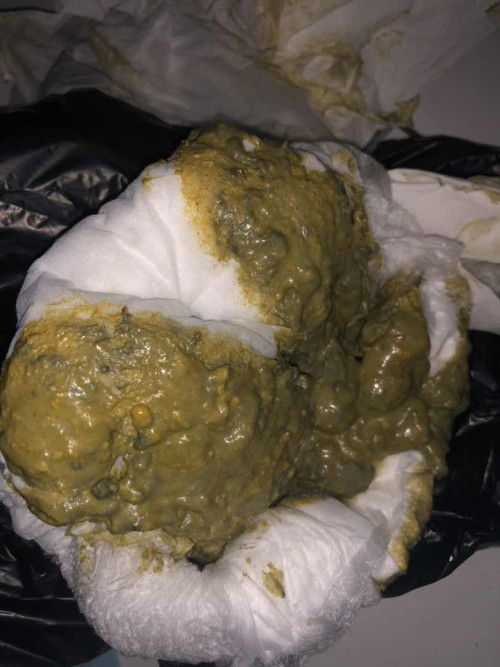 Fases bayi berwarna hijau tua