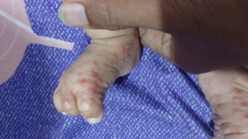 Ini kenapa ya 🙂‍↕️ sudah 3x periksa dann dikasi obat dan salep tapi tetep gak sembuh. Jadi bingung