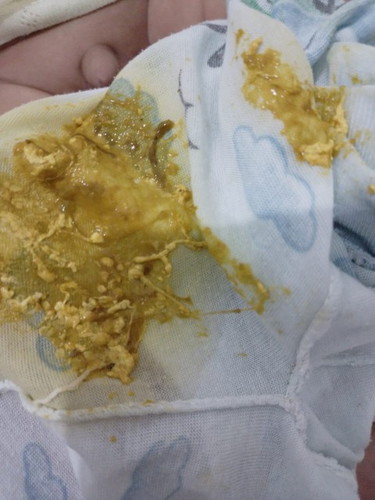 Ada yg pernh kya gini gak pup bayi nya ini knp ya normal kah ? Full asi usia 45 hari