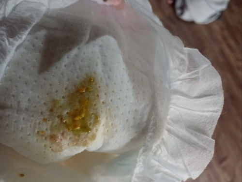 ลูก1เดือน 16 วัน ถ่ายแบบนี้ปกติไหมคะ