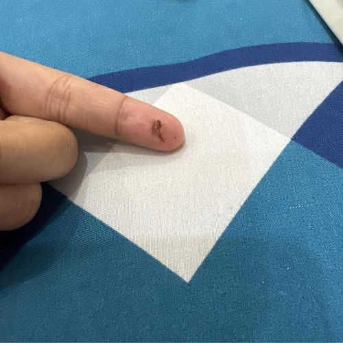 Lendir Coklat Sedikit