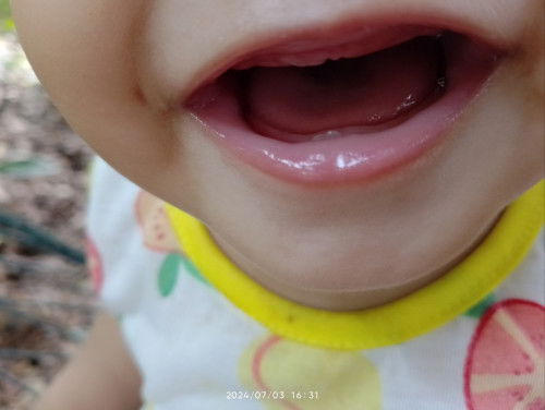Teething .