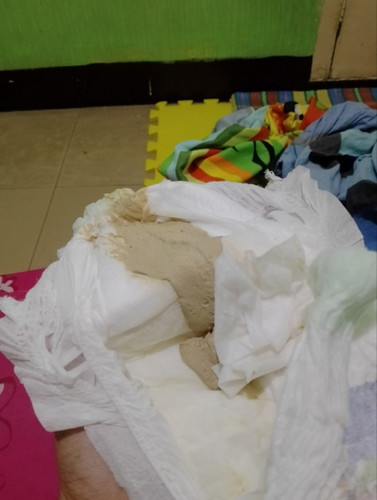 Normal lang ba ang color Ng poop Ng baby ko?