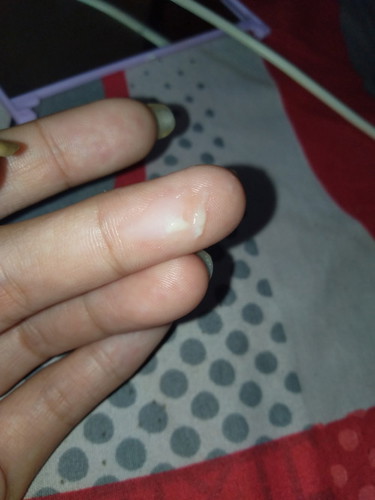 keputihan saat hamil 9minggu
