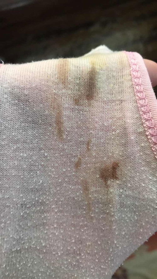 เลือดออกแบบนี้ควรไปโรงบาลเลยมั้ยคะ