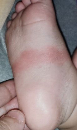 Hello po mga mommy.. Ask ko lang po sana kung anu po kaya ito? May nka experience na po ba ng ganto?